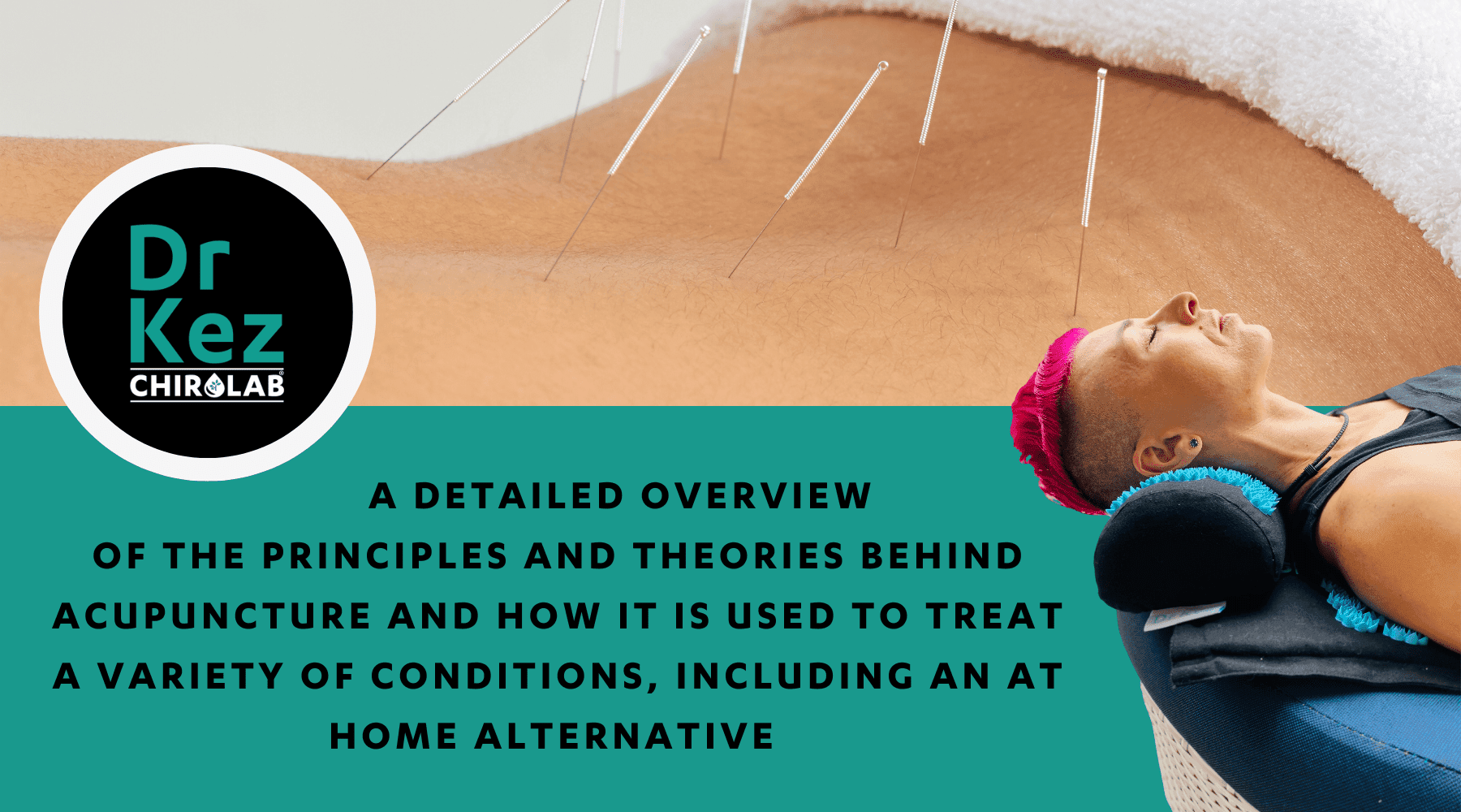 A detailed overview of the principles and theories behind acupuncture and how it is used to treat a variety of conditions, including an at home alternative - Dr Kez Chirolab 
