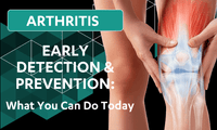 Arthritis Early Detection & Prevention: What You Can Do Today