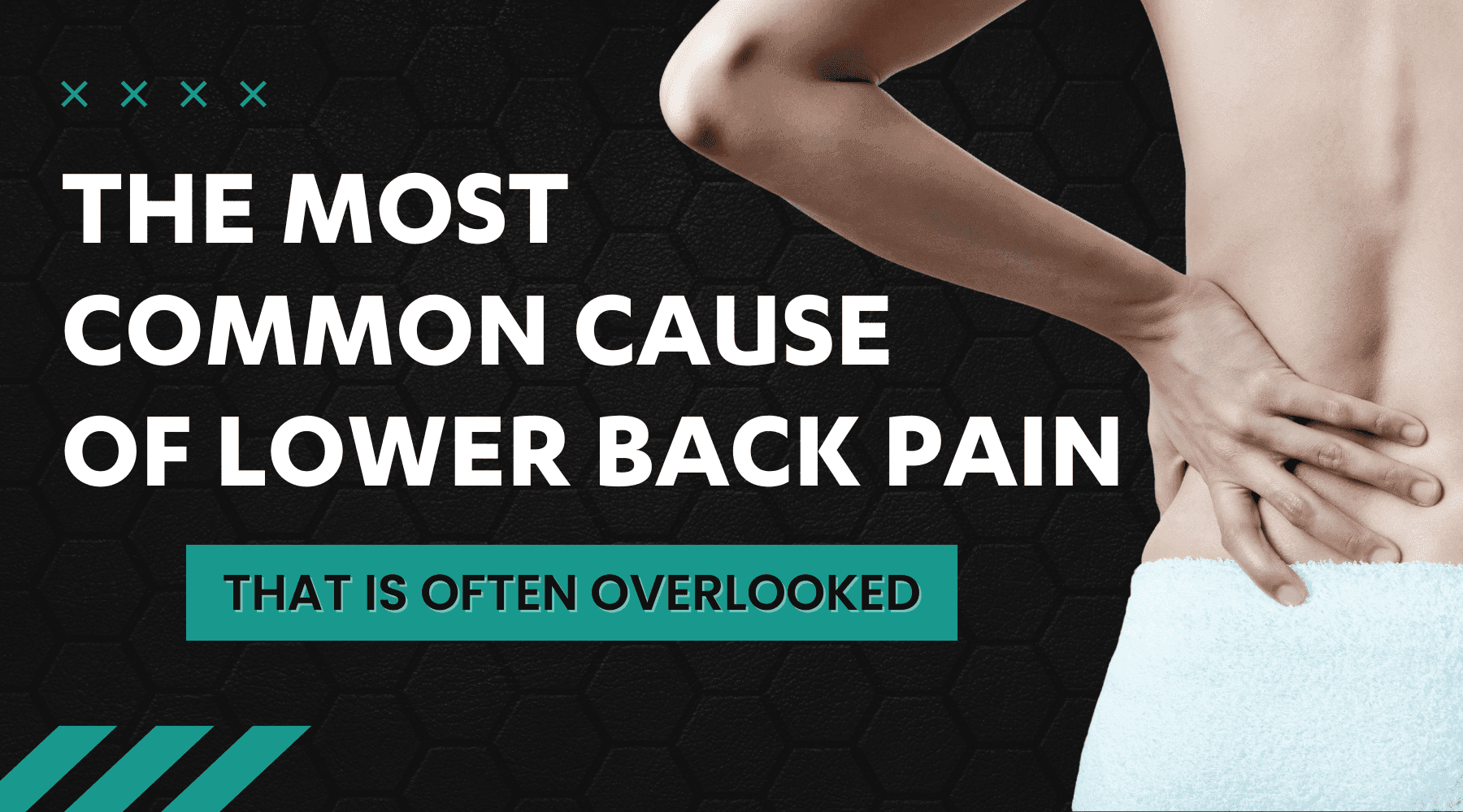 The most common cause of lower back pain, that is often overlooked 👀 - Dr Kez Chirolab 